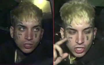 Tras recibir el alta, Eloy Rivera habló del ataque a su ex: "Ella quiso…"