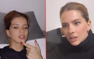 La China Suárez se "operó la cara" y mostró cómo le quedó