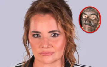 Nancy Pazos se sometió a un tratamiento estético y se burlaron de cómo quedó su rostro