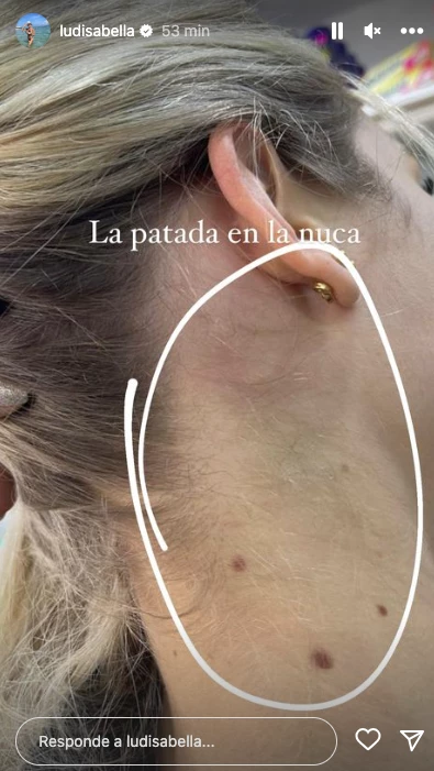 La pareja Lautaro Acosta lo denunció por violencia