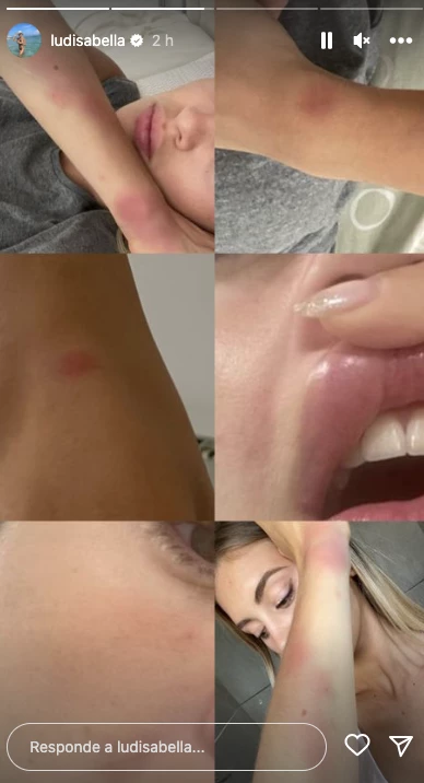 Así quedó Ludmila Isabella, la pareja de Lautaro Acosta