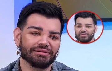 Fran Mariano se salvó de la amputación del pie y enfrentará una riesgosa cirugía