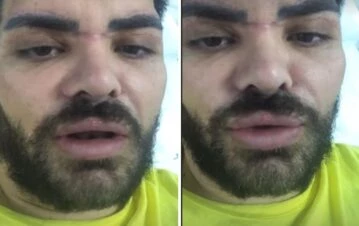 La gravísima denuncia de Fran Mariano contra su familia: "Estoy internado hace 11 días y..."