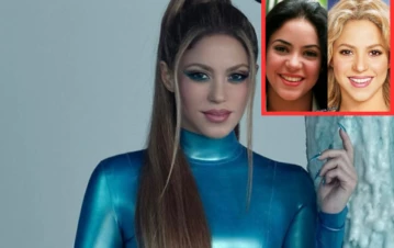 Antes y después: revelan la lista completa de cirugías que se hizo Shakira a lo largo de su carrera