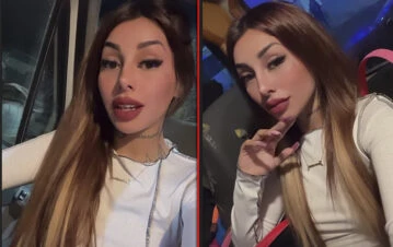 ¿Era necesario? Tamara Báez se hizo el rejuvenecimiento de moda y encima mostró los resultados