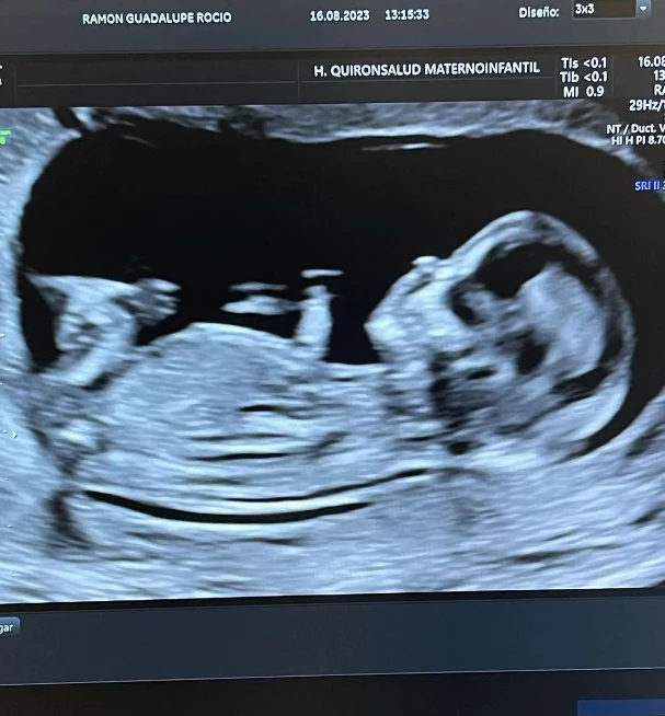 Guido Rodríguez tendrá a su segundo hijo