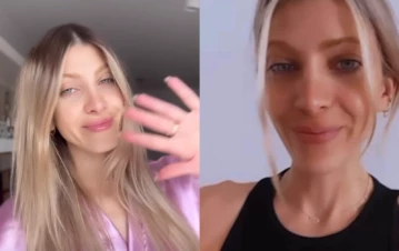 Cande Ruggeri explicó por qué mete la cara en hielo casi a diario