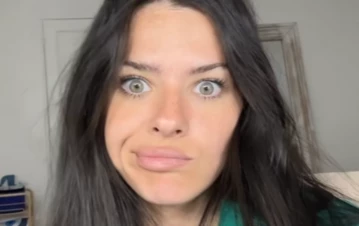 La China Suárez reveló la verdad sobre su cicatriz en la frente