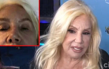 Susana Giménez enfrente un duro problema de salud: "No duermo de noche, tengo que..."