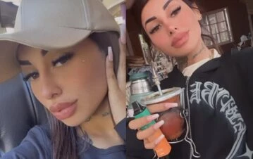 El error de Tamara Báez por el que casi se deforma la cara luego de realizarse un retoque estético