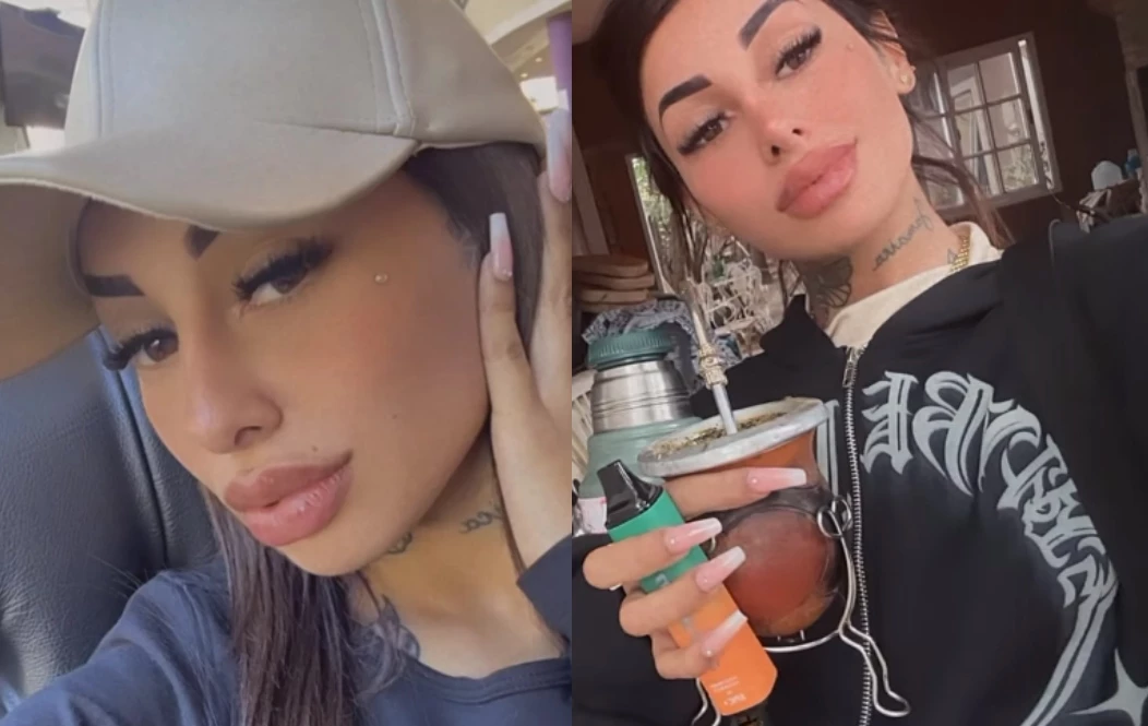 Tamara Báez tomando mate luego de un retoque estético.