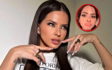 La China Suárez reveló su gran secreto de belleza: con qué combate el acné