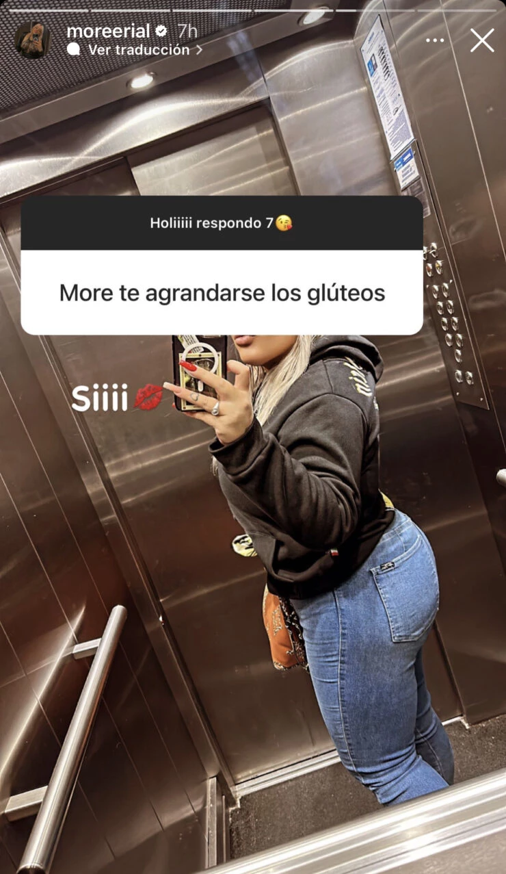 Las fotos intimas de Morena Rial tras someterse a una cirugia de aumento de gluteos I