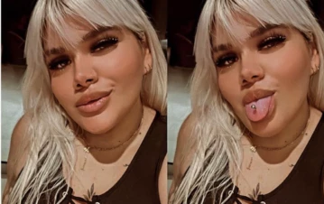 Las fotos íntimas de Morena Rial tras someterse a una cirugía de aumento de glúteos