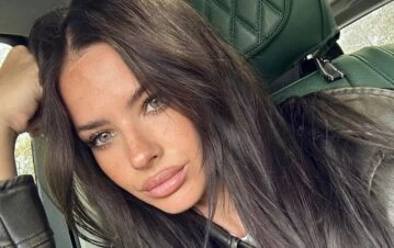 A la China Suárez le salió un grano en la cara  y se obsesionó: “En cualquier momento me choca los…”