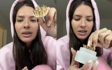 El “fail estético” de la China Suárez al mostrar un retoque que se hizo en la cara: “Parece que me…”