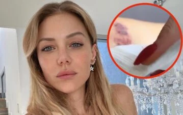 ¡Qué impresión! Evangelina Anderson mostró cómo le quedó la piel tras sacarse los tatuajes