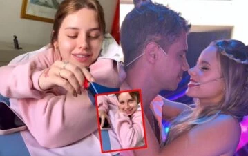 Coti Romero mostró cómo le borraron el tatuaje que se había hecho por el Conejo