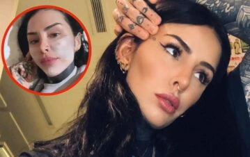 ¡Otro retoque! Cande Tinelli mostró el innovador tratamiento rejuvenecedor al que se sometió