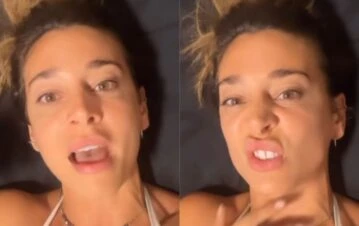 Sol Pérez se volvió adicta a un retoque estético: “Empecé, seguí, me puse más y más, me arrepiento muchísimo”