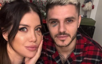 Wanda Nara reveló cuál es la solución que encontró al ojo morado de Mauro Icardi