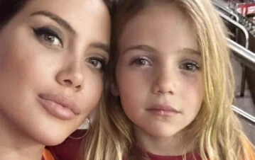 El accidente de la hija menor de Wanda Nara que terminó con el mismo drama estético que sufrió ella