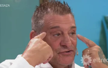 El Turco García reveló todos los retoques estéticos que se hizo