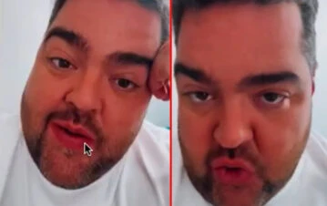 Darío Barassi contó todos los detalles de las dos cirugías por las que no saldrá en TV: "No me van a reconocer"