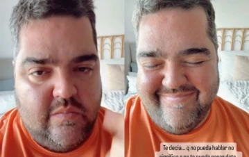 El video de Darío Barassi tras recibir el alta por una cirugía: cómo se comunica