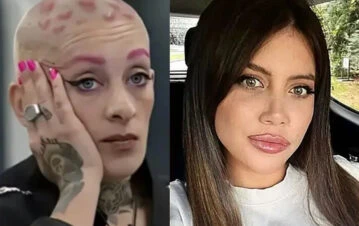 Cuáles son las diferencias entre la enfermedad de Furia de Gran Hermano y la de Wanda Nara
