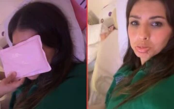 La China Suárez sufrió un accidente y se fracturó la nariz: las fotos