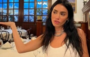 Lali Espósito mostró cómo le quedó la piel tras quemarse con el sol