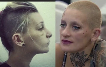 ¡Las fotos! Descubren que Furia se hizo una cirugía plástica y la acusan de mentir con su pasado pobre