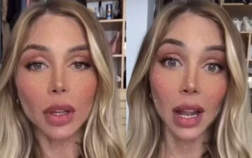 El drama bucal de Romina Malaspina por una sustancia que le arruinó los labios: “Están duros como...”