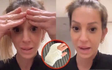 El terrible accidente doméstico del hijo de Noelia Marzol: “Carne saliendo, le dieron puntos”