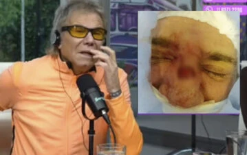 Impactante testimonio de Beto Casella sobre su problema de salud: "Un pequeño cáncer, un tumor, me quedó un..."