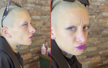 Furia se va hacer una cirugía estética de canje: qué se retocará de su rostro