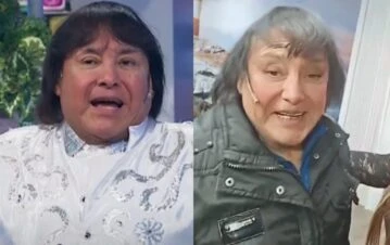 El increíble drama que sufre Ricky Maravilla por su operación de cara: “Le bloquearon la cuenta del banco porque…”