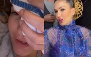 Así le quedó la cara a Isabel Macedo tras su tremendo accidente: “Lloré y me angustié”