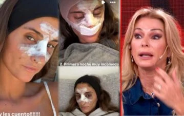 Por qué Lola Latorre se hizo una gran cirugía estética en su nariz