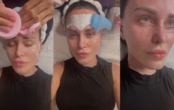 Natalie Weber mostró cada detalle del tratamiento que le cambió la imagen por completo