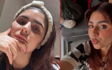 Le exigieron a Camila Mayan que se operara con urgencia la cara: qué dijo la ex de Alexis Mac Allister