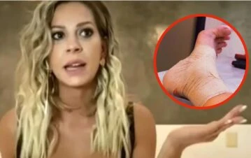 Noelia Marzol se accidentó en plena función en Villa Carlos Paz: “Me duele y...”