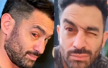 ¡Qué impresión! Las fotos del Tucu López que preocuparon y pusieron en alerta a todo el mundo: "Me metieron el dedo mal"