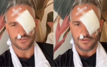 El terrible accidente que sufrió Papucho de Gran Hermano en la ambulancia: "Se lesionó gravemente el…"