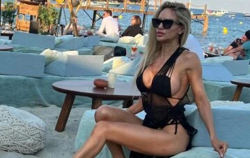 Cómo es el tratamiento que se hace Luciana Salazar y le llena de moretones su cuerpo