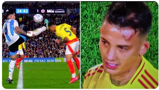 UNO DE LOS MOMENTOS MAS DRAMATICOS DE LA NOCHE. EL PLANCHAZO DE ENZO FERNANDEZ QUE LE COSTO LA EXPULSION. KEVIN CASTAÑO QUEDO COMO AL PACINO: "CARA CORTADA".