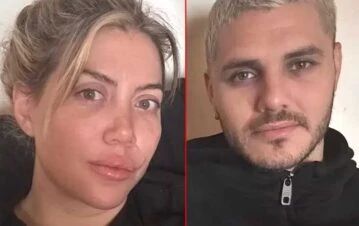 Wanda Nara contó el trauma que le dejó su escandalosa separación de Mauro Icardi