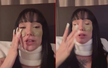 La Joaqui se accidentó en un show en Italia y terminó internada de urgencia