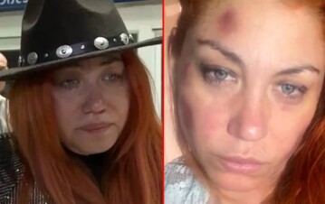 El escalofriante dato sobre la desaparición de Lowrdez de Bandana: “Hematomas de un golpe en…”